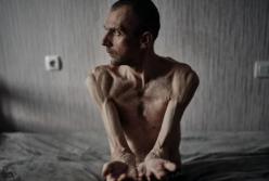 Росія приховує від Червоного Хреста хворих та закатованих українських полонених, – звіт ОБСЄ