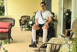 Во время катания на гидроцикле мужчина подхватил опасную болезнь (фото)