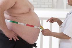 Ученые выяснили, сколько лет жизни крадет у человека ожирение 