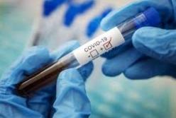 В Украине 3 261 новый случай COVID-19