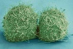 Медики выявили необычное состояние организма при возникновении рака