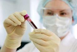 В России число заразившихся коронавирусом приблизилось к сотне