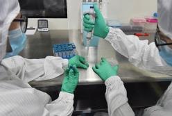 В МИД подтвердили заражение украинки коронавирусом в Италии