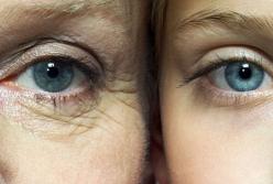 Генетика и не только: ученые назвали новые причины появления морщин