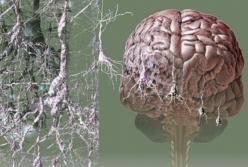 Медик перечислил признаки старческого слабоумия