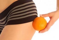 Эти продукты помогут в борьбе с целлюлитом
