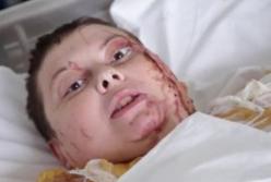 Дело Гандзюк: СБУ говорит о других заказчиках