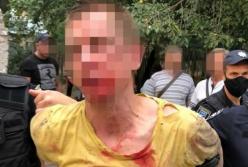 В Днепре мужчина бросил гранату в дом, есть пострадавшие