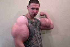 "Руки-базуки" готовится к операции по удалению своих знаменитых бицепсов