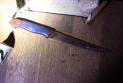 На Харьковщине 7-летняя девочка с ножом напала на свою бабушку – женщина в реанимации (фото)
