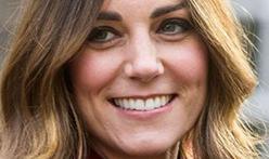 31-летняя Кейт Миддлтон удивила морщинами на лбу и седыми волосами (фото)