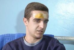 Электронная сигарета взорвалась, едва не лишив жизни молодого парня  (видео)