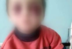 6-летний мальчик еле остался в живых после истязаний отца (видео)