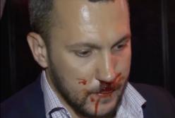 Теперь конфликты принято решать силой: кровавая драка депутатов Мельничука и Линько (видео)