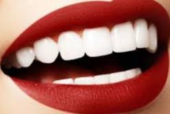 Как отбелить зубы без вреда? (видео)