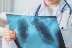 Насколько вреден рентген: доктор Комаровский (видео)