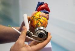 В Киеве провели уникальную операцию по имплантации механического сердца (видео)