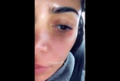 Ким Кардашьян показала пораженное псориазом лицо (видео)