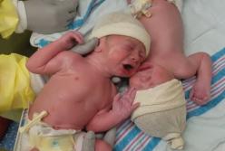 Эти близнецы поднимают громкий бунт, если их пытаются разъединить даже на секунду (видео)