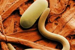 Врачи назвали признаки заражения организма паразитами (видео)