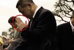 Почему некоторые люди сами отрезают себе пальцы? (видео)