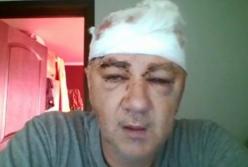 В Одесской области жестоко избили ветерана АТО (видео)
