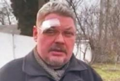 «Титушки» Московского патриархата избили священника ПЦУ (видео)