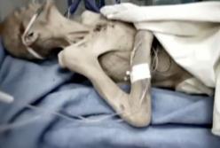 Страшная смерть пенсионерки, которую до ужасного состояния довел сын: голод, побои и онко (видео)