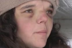 Задержали мачеху избитого до полусмерти Вани: интервью с горе-родителями (видео)