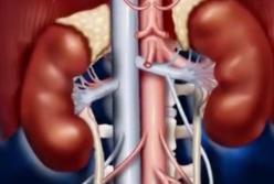 Что убивает наши почки? (видео)