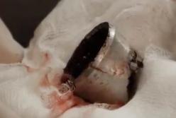 Новые подробности: взрыв на детской площадке - откуда взялся снаряд? (видео)