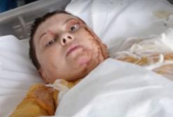 Выгляжу лучше, чем справедливость в Украине: Гандзюк опубликовала обращение (видео)