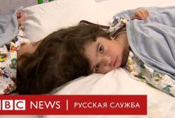 В Британии провели уникальную операцию по разделению сиамских близнецов (видео)