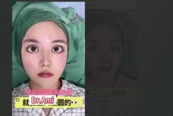 У азіаток новий криповий б'юті-тренд - "Барбі-очі": це пластика по збільшенню очей (відео)