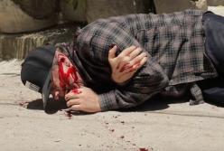 В сеть попали кадры вооруженного нападения на Дмитрия Комарова: он весь в крови (видео)