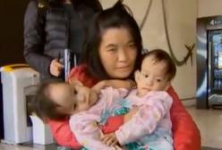 ​Сиамские близнецы после операции по разделению вернулись домой (видео)