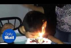 Волосы мальчика загорелись, когда он решил откусить праздничный торт (видео)