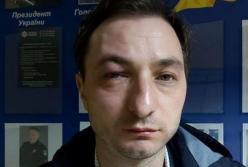 В Киеве жестоко избили главврача Нацинститута рака (видео)