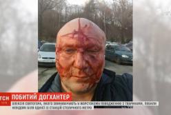 Известного догхантера Алексея Святогора жестоко избили в Киеве (видео)