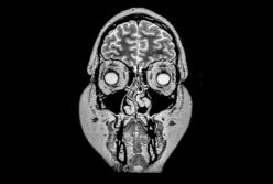 Женщина выпила 11 литров воды за 2 часа и вот что с ней случилось