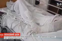 В Запорожье мужчина сварил сожительницу в кипятке (видео)