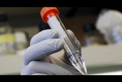 Второй в мире случай излечения ВИЧ (видео)