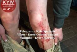 В Киеве пьяные военнослужащие прострелили ноги ветерану АТО (видео)