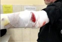 Пьяный мужчина натравил бойцовского пса на людей: есть пострадавшие (видео)