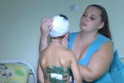 Под Днепром пес искусал пятилетнего ребенка (видео)