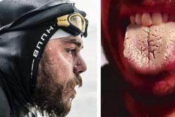 Мужчина 157 дней плавал в открытом море. Посмотрите, что с ним случилось (видео)