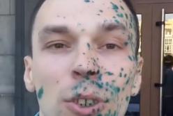 Душ из зеленки: 32-летнего блогера обвиняют в государственной измене (видео)