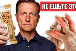 Відмовтеся від цих 7 продуктів при артриті та болю в суглобах: головні ідеї з відео Dr. Eric Berg