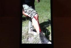 Появилось видео нападения на пограничников на Буковине (видео)