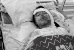 Муж сжег свою 22-летнюю жену, облив ее бензином из-за ссоры (видео)